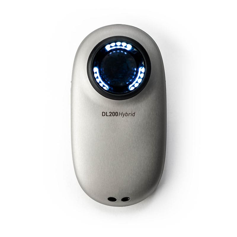 Dermlite Dl200 Hybrid Dermatoscope | Diagnostic Device For Quick And Easy Dermoscopy