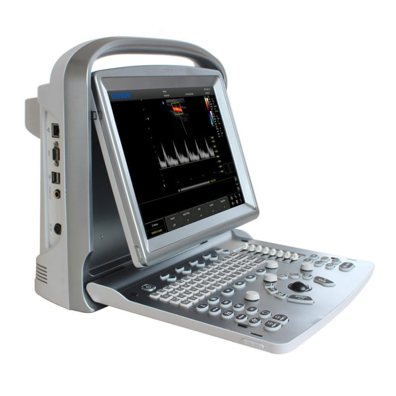 Chison Eco5 Ultrasound Machine With Colour Doppler & Multilingual Software
