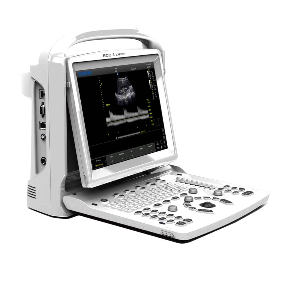 Chison Eco3 Expert Ultrasound Machine With 12 Inch Led Display