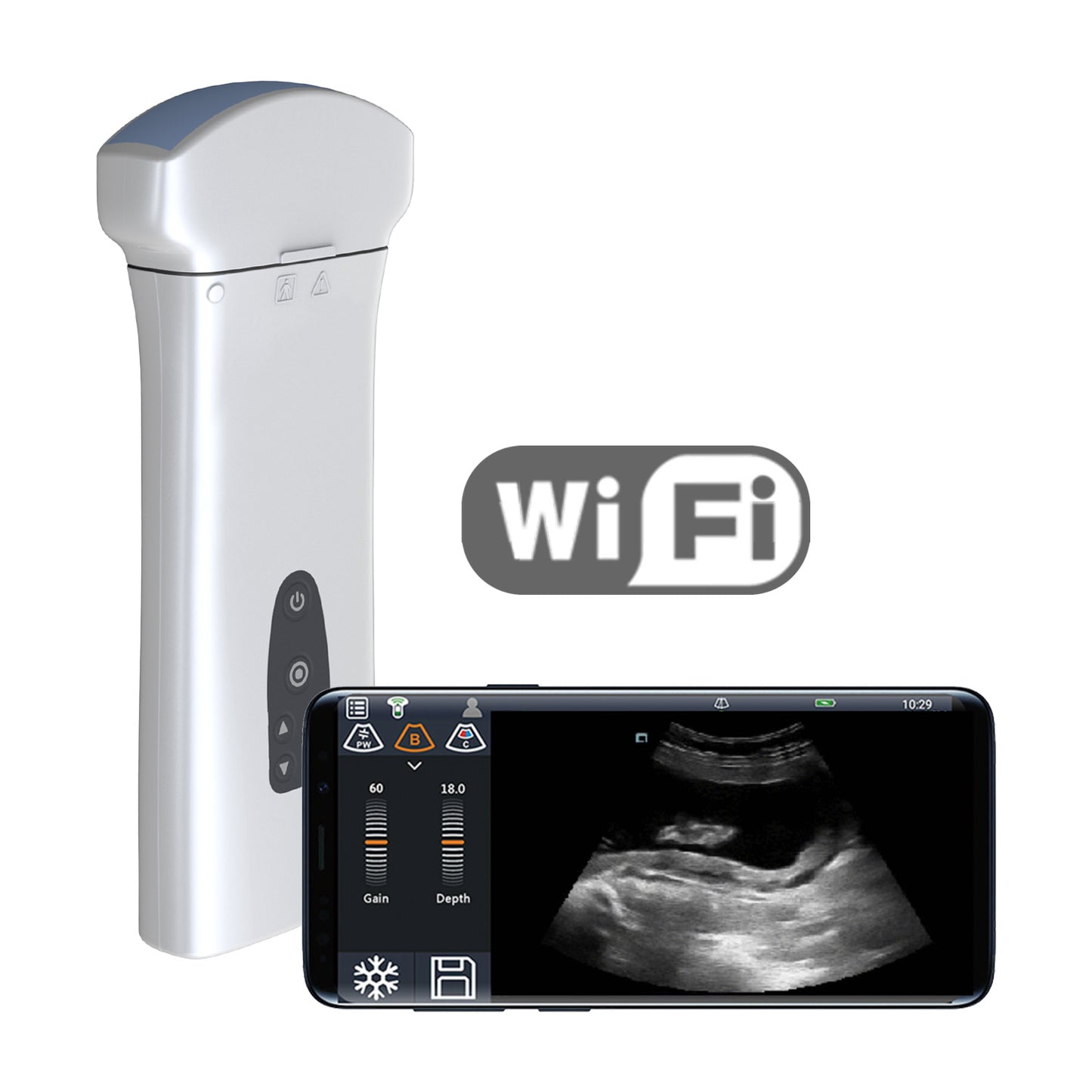 Youkey D8 Mobile Wireless Ultrasound Machine With Wifi