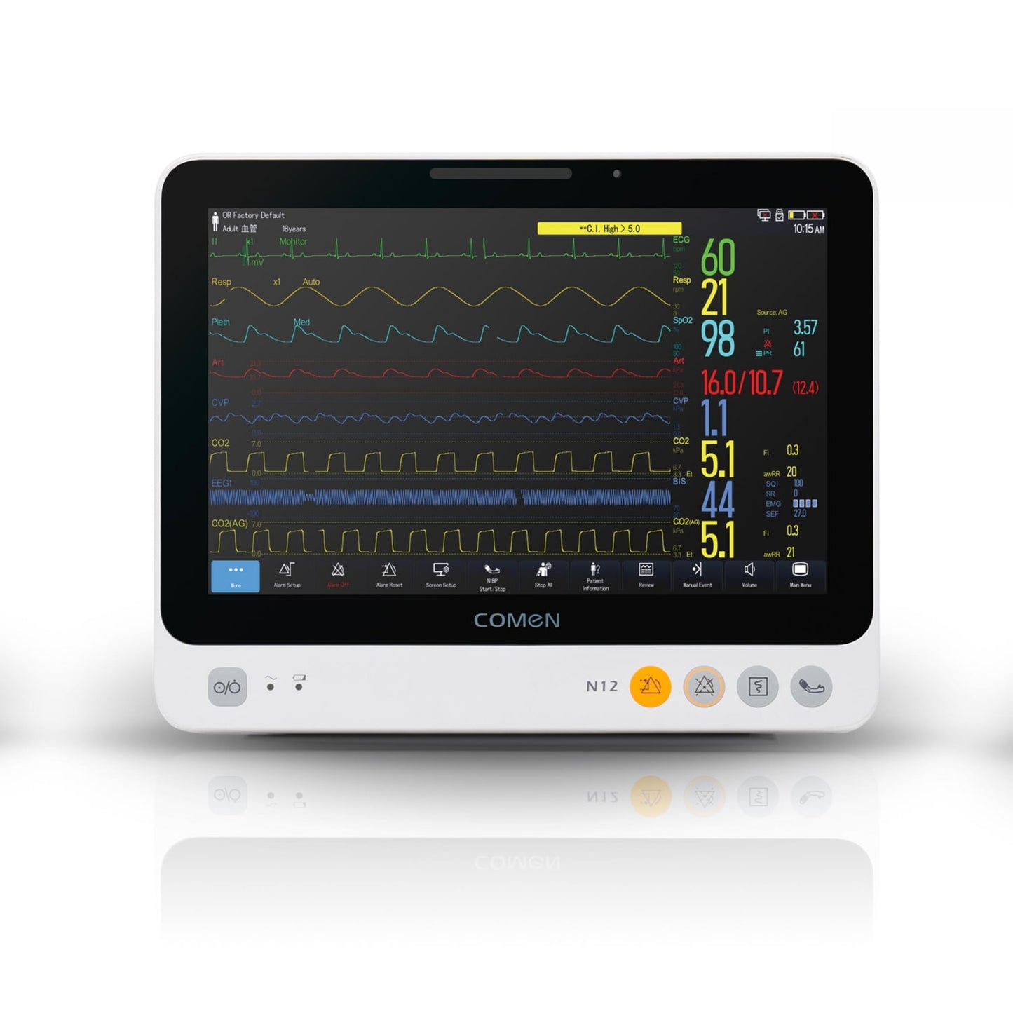 Comen N12 Patient Monitor For Simple And Continuous Patient Monitoring