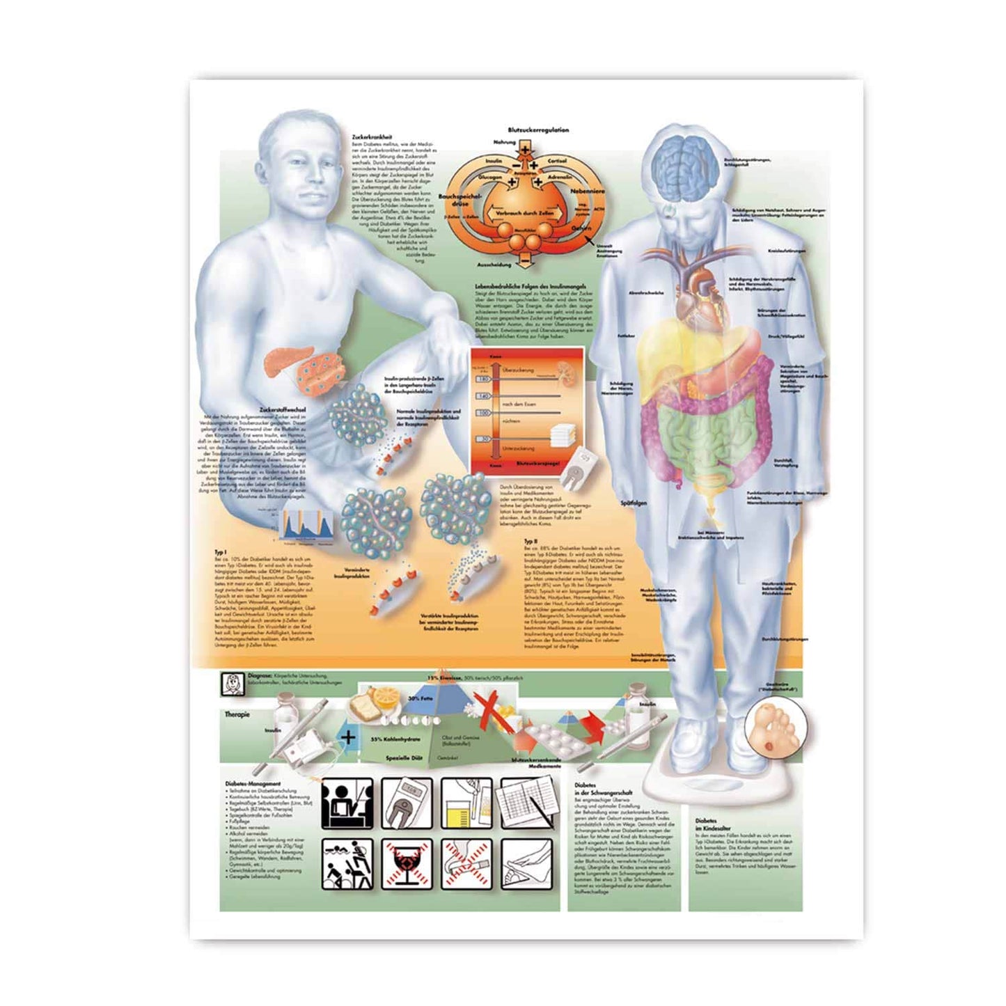 Diabetes Wall Chart With Coloured Illustrations And Detailed Inscriptions
