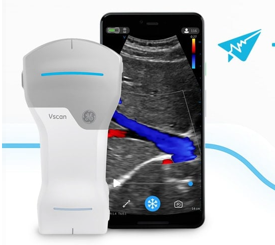 Vscan Air CL Ultrasound System