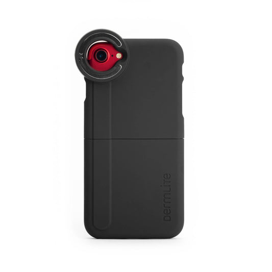 Smartphone/Tablet Adapter For Dermlite Dermatoscopes