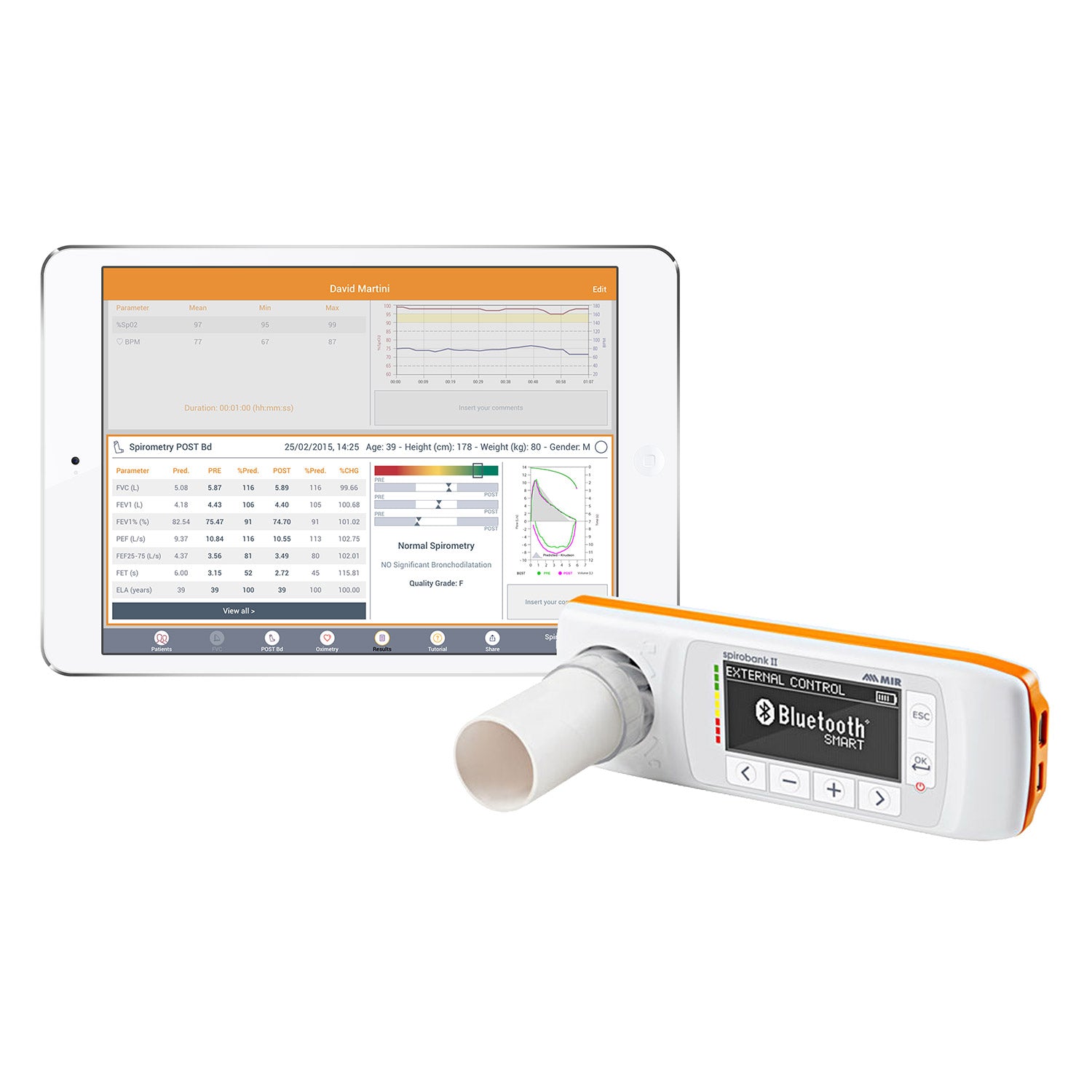New Spirobank Ii Smart For Ios Or Android Tablets With Gdt Interface For Data Transfer
