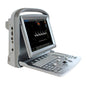 Chison Eco5 Ultrasound Machine With Colour Doppler & Multilingual Software