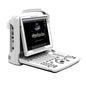 Chison Eco3 Expert Ultrasound Machine With 12 Inch Led Display