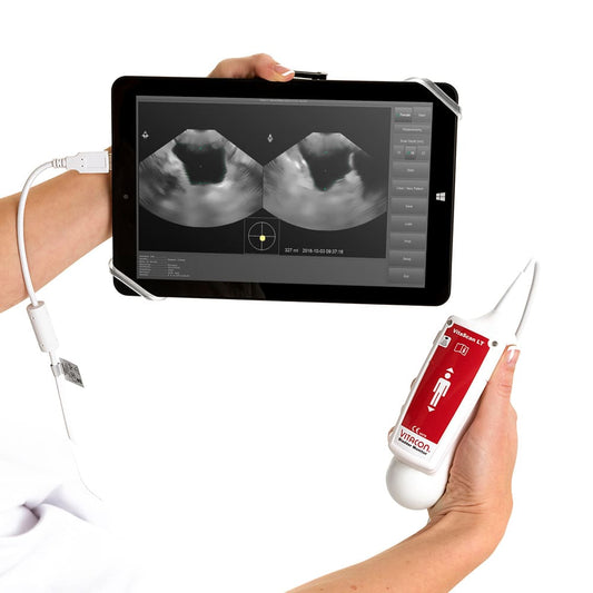Vitascan V.2 Bladder Scanner | Optionally Available With Windows Tablet