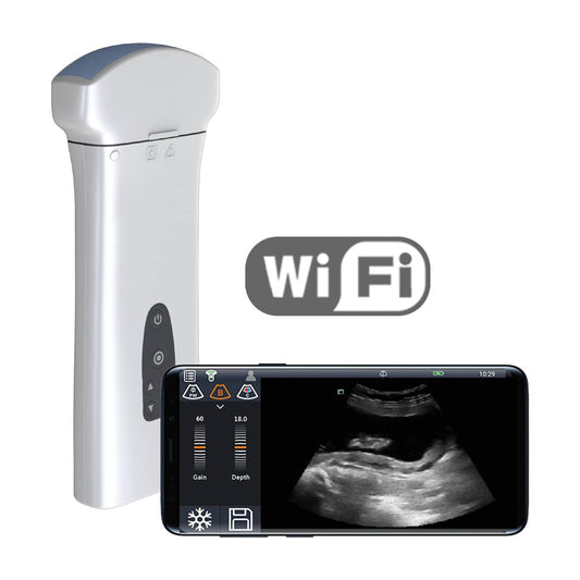 Youkey D8 Mobile Wireless Ultrasound Machine With Wifi