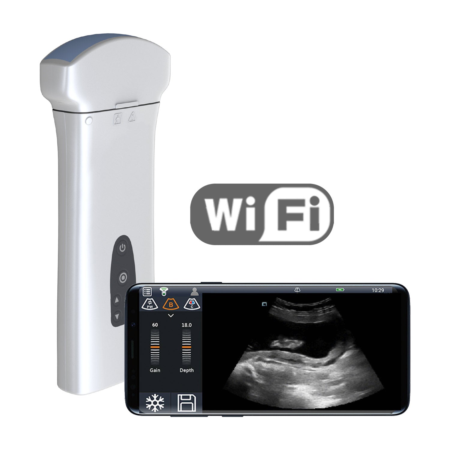 Youkey D8 Mobile Wireless Ultrasound Machine With Wifi