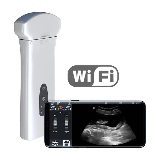 Youkey D8 Mobile Wireless Ultrasound Machine With Wifi