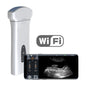 Youkey D8 Mobile Wireless Ultrasound Machine With Wifi