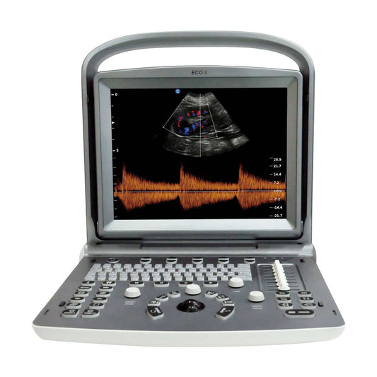 Chison Eco 6 Ultrasound Machine With 12 Inch Led Colour Display