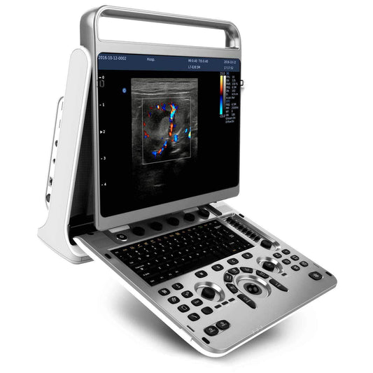 Portable Chison Ebit 30 Ultrasound Scanner Comes With A Convex And A Linear Probe