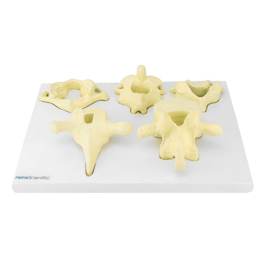 Model Of Vertebrae Types From Heinescientific