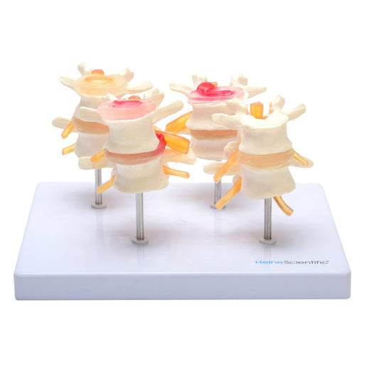 Heinescientific Intervertebral Disc Model   4 Pieces