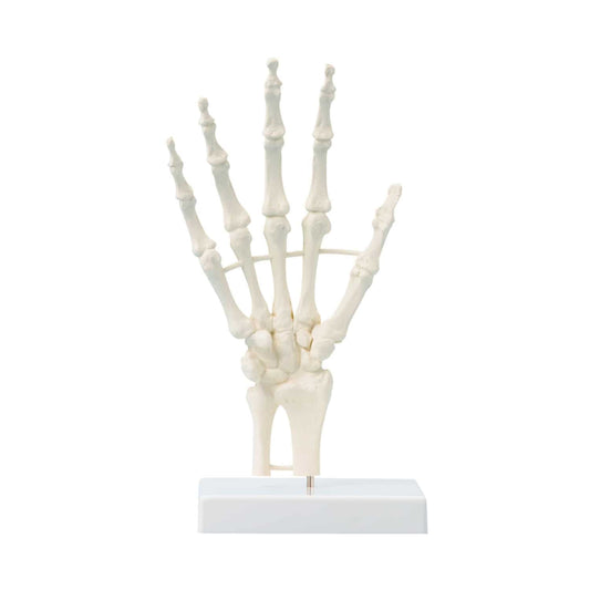 Hand Skeleton From Erler-Zimmer   Mounted Immovably On A Stand