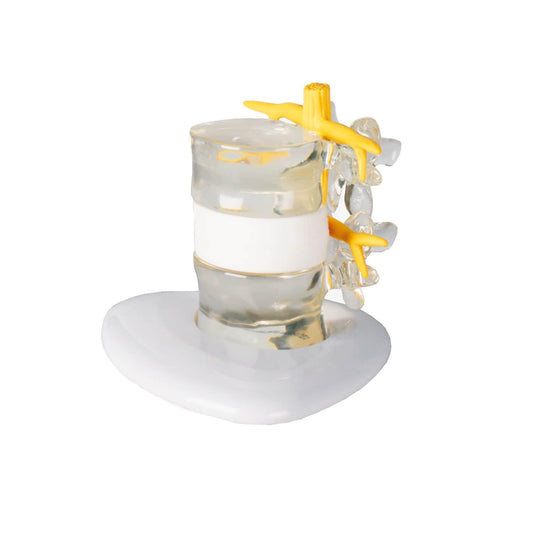 Erler-Zimmer Herniated Disc Simulator (Double Life Size)