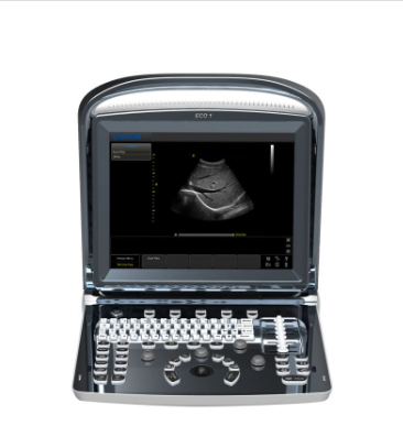 Chison ECO 1 Ultrasound Machine with rechargeable battery | linear transducer (L7M-A)