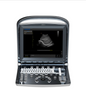 Chison ECO 1 Ultrasound Machine with rechargeable battery | linear transducer (L7M-A)